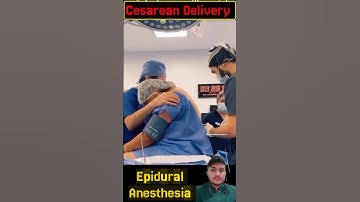 Cesarean Anesthesia #epiduralinjection #backpain #cesareanbirth