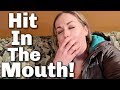 I WAS HIT IN THE MOUTH!
