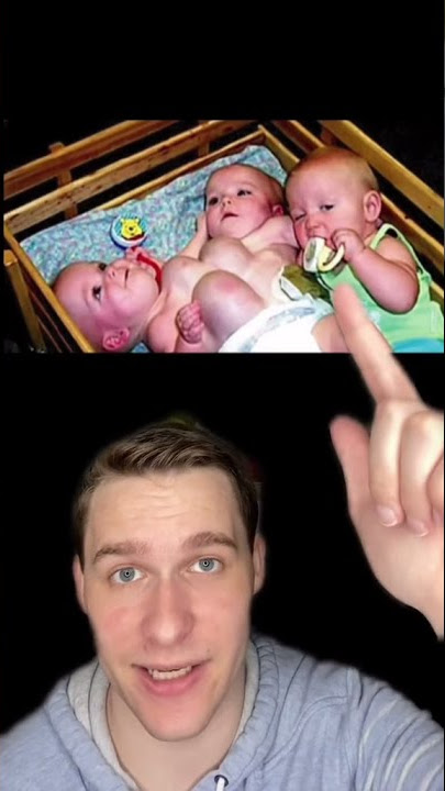 Kembar Terlangka di Dunia #shorts