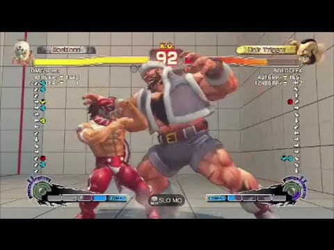 SSFIV AE v2012 : DMG iPeru ( El Fuerte ) VS BOLOFLEX ( Zangief ) Ranked Match On Xbox 360