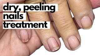 How to effectively condition dry, brittle nails! Start TODAY!!