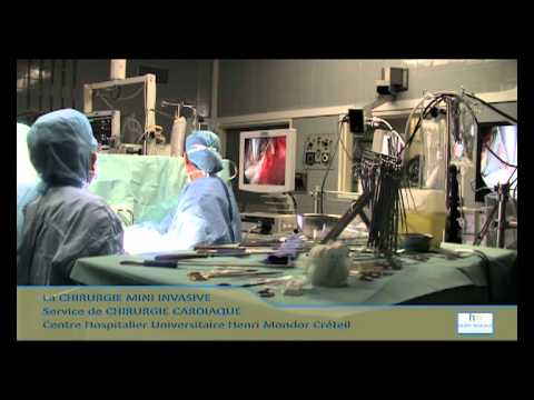 Vidéo: Quand la chirurgie mini-invasive a-t-elle été inventée ?