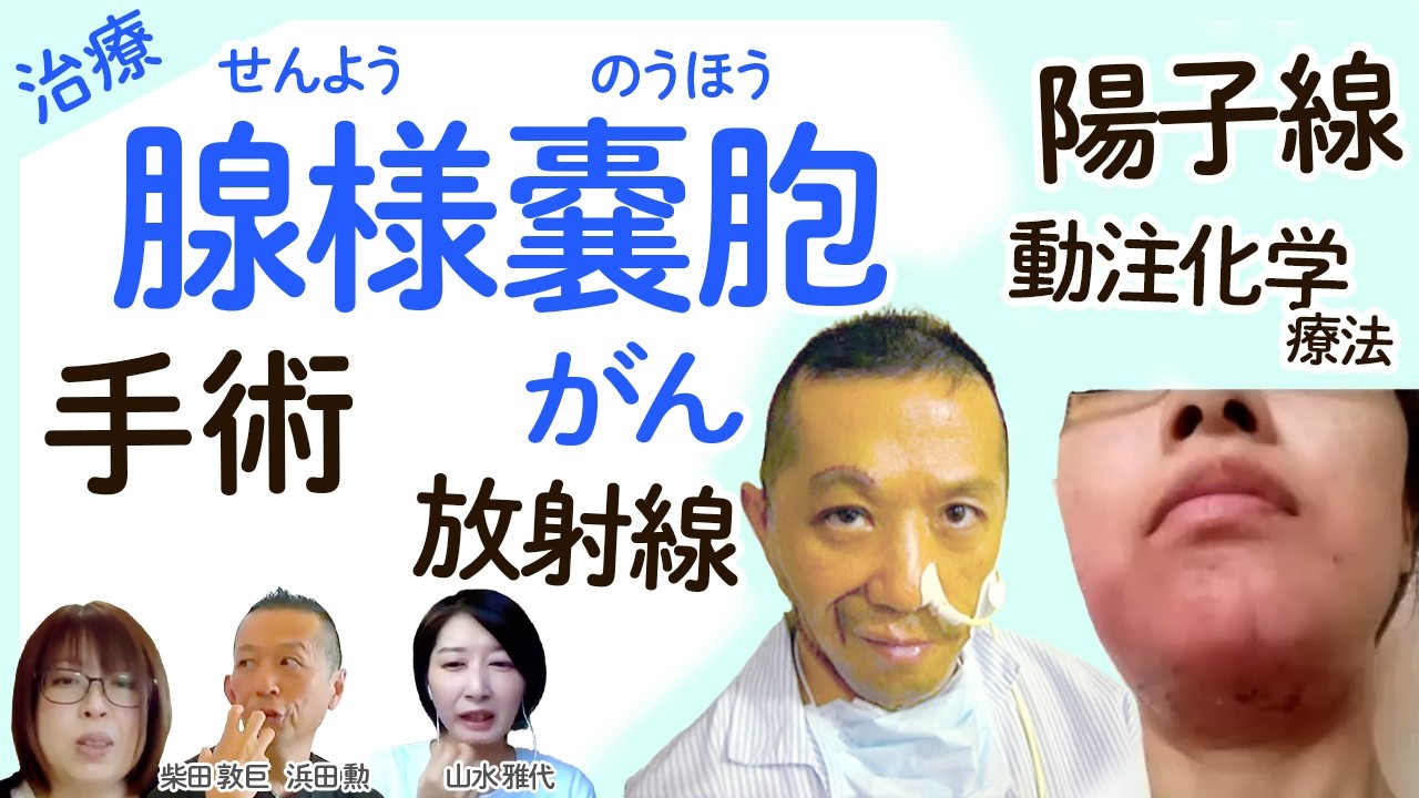 腺様嚢胞（せんようのうほう）がん 治療】顔面神経再建術・化学放射線 