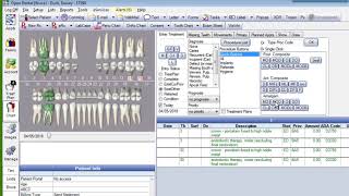 Entering Treatment Plans in Open Dental