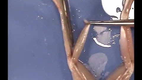 Frog Dissection - Free Gastrocnemius