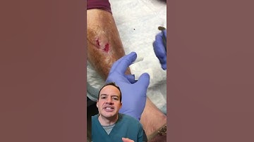 DOCTOR REACTS: ARTIFICIAL SKIN FOR A WOUND!? 😱 #shorts