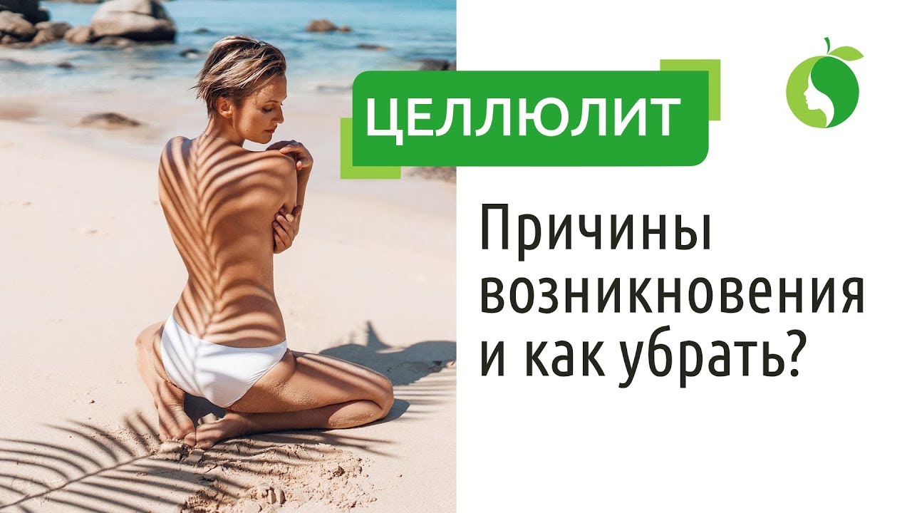 Целлюлит | Причины возникновения и как убрать? - YouTube