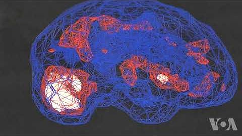 Using Neuroimaging Scans For Diagnosing Mental Illness
