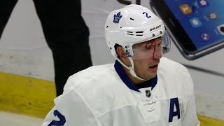 Gotta See It Hunwick Bloody After Huge Hit By Neil