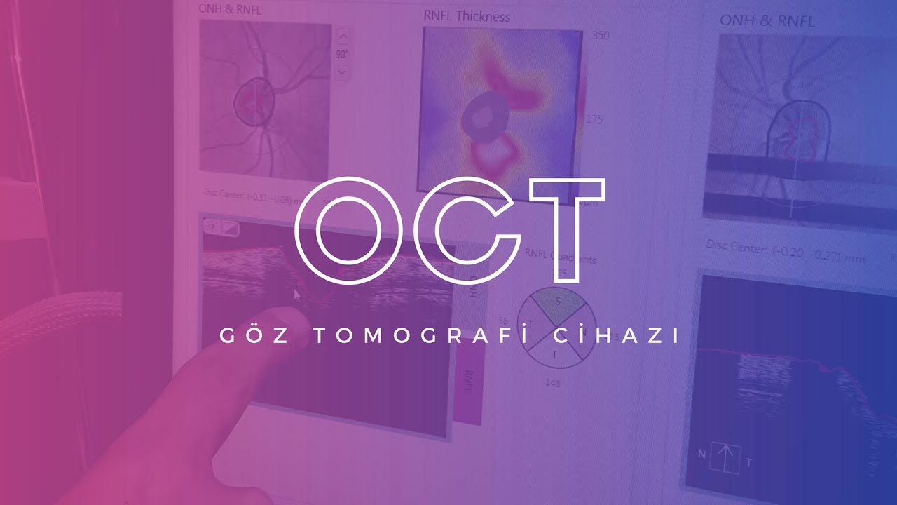 Oct Goz Tomografi Cihazi Opr Dr Celal Yeter Youtube Oct Goz Tomografi Cihazi Opr Dr Celal Yeter Youtube