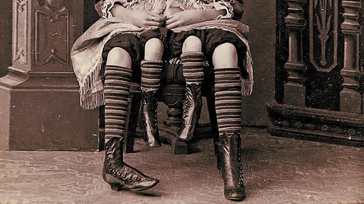 The Story Of Myrtle Corbin, The Real Four Legged G...