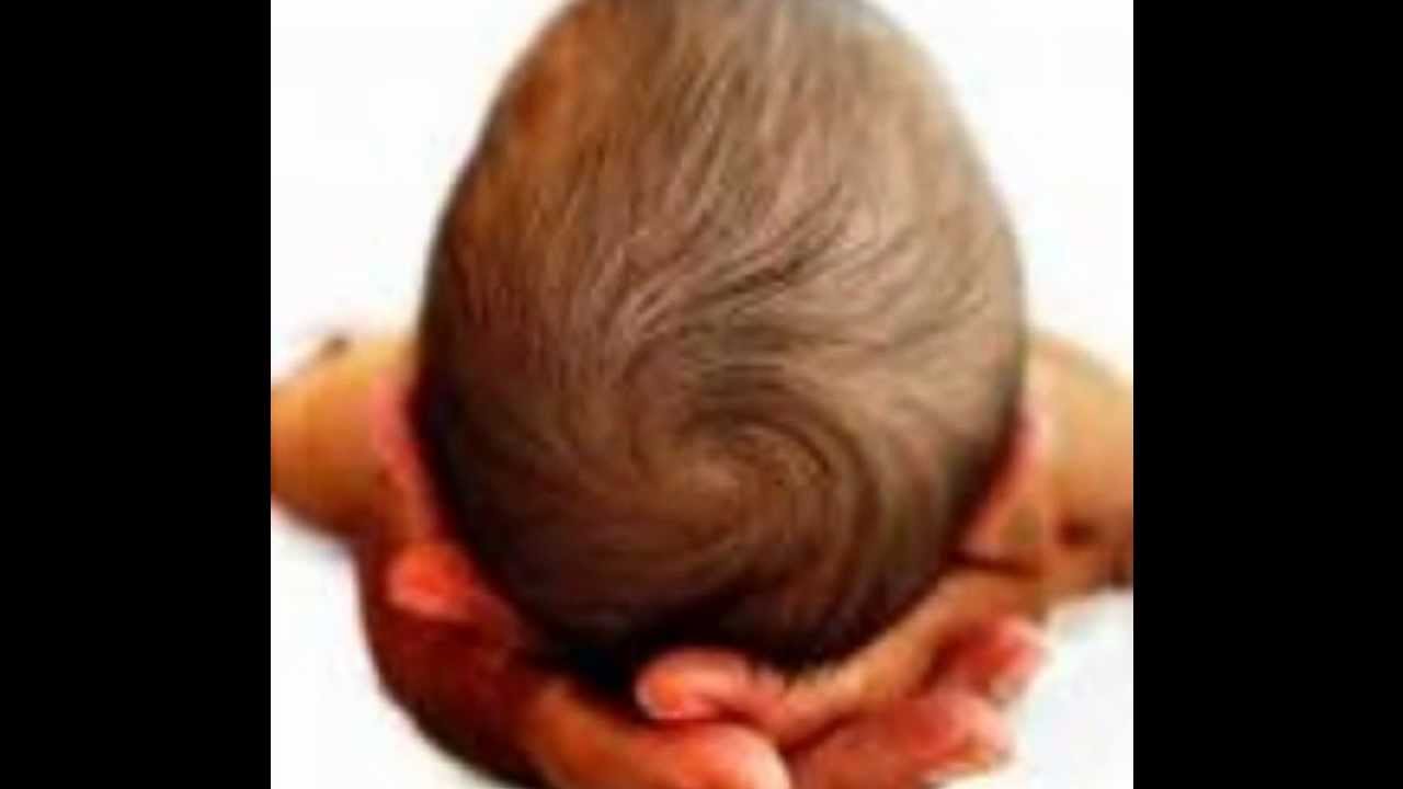 роднички у новорожденных анатомия. темечко где находится фото. большой и малый родничок у новорожденного зарастает. краешек темечко. краешек темечко.