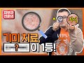 기미 제거에 탁월한 '1등 성분'을 공개합니다! (10년째 진료에 쓰고있는 성분)