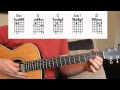 Centuries - Fall Out Boy Guitar Lesson