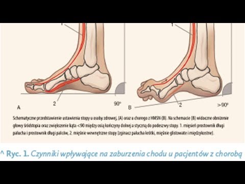 Wideo: Co to jest faza czuciowo-ruchowa?