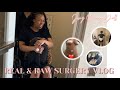 SURGERY WITH DR. JUNG | BBL Surgery + Recovery Days 1 - 4