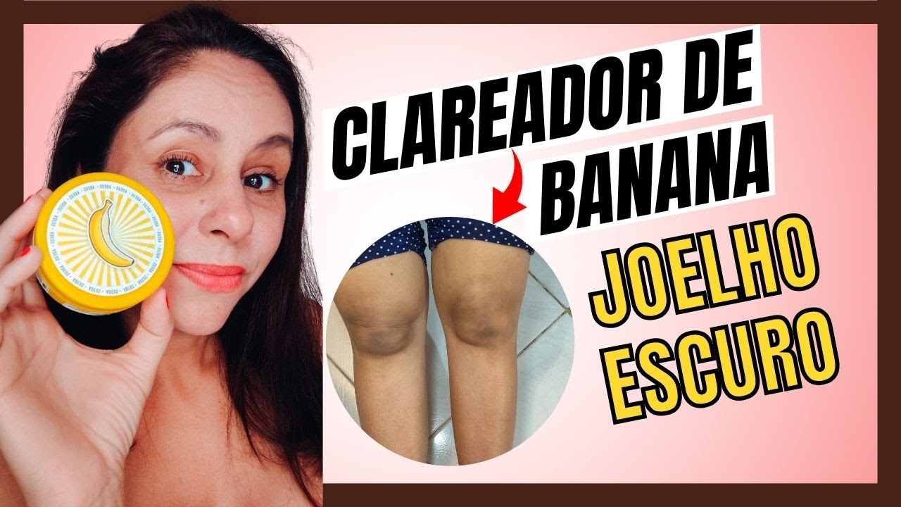 COMO CLAREEI MEU JOELHO USANDO ADEUS DE BANANA