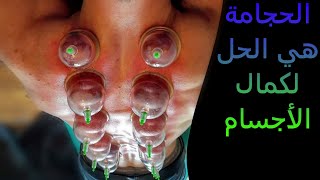 الحجامة واجبة على ممارسي كمال الأجسام بالجزائر | HiJAMA EN ALGÉRiEN