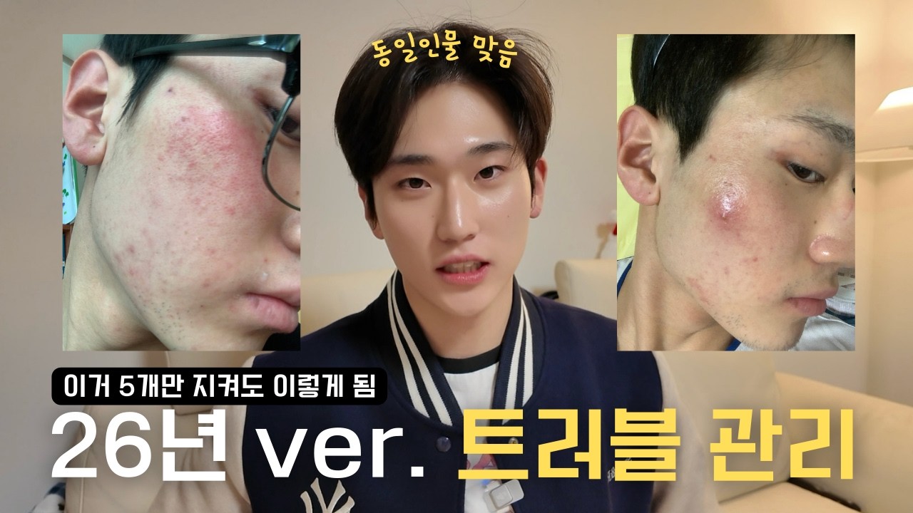 광고❌, 내가 피부과 가지 않고 트러블 관리하는 5가지 방법🔥 (26년도 버전)
