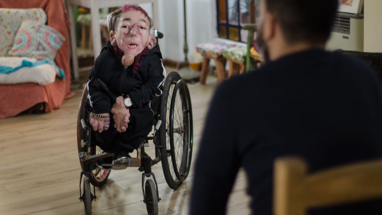 “YO QUIERO QUE SEPAN QUE SOY TAN NORMAL COMO CUALQUIERA”