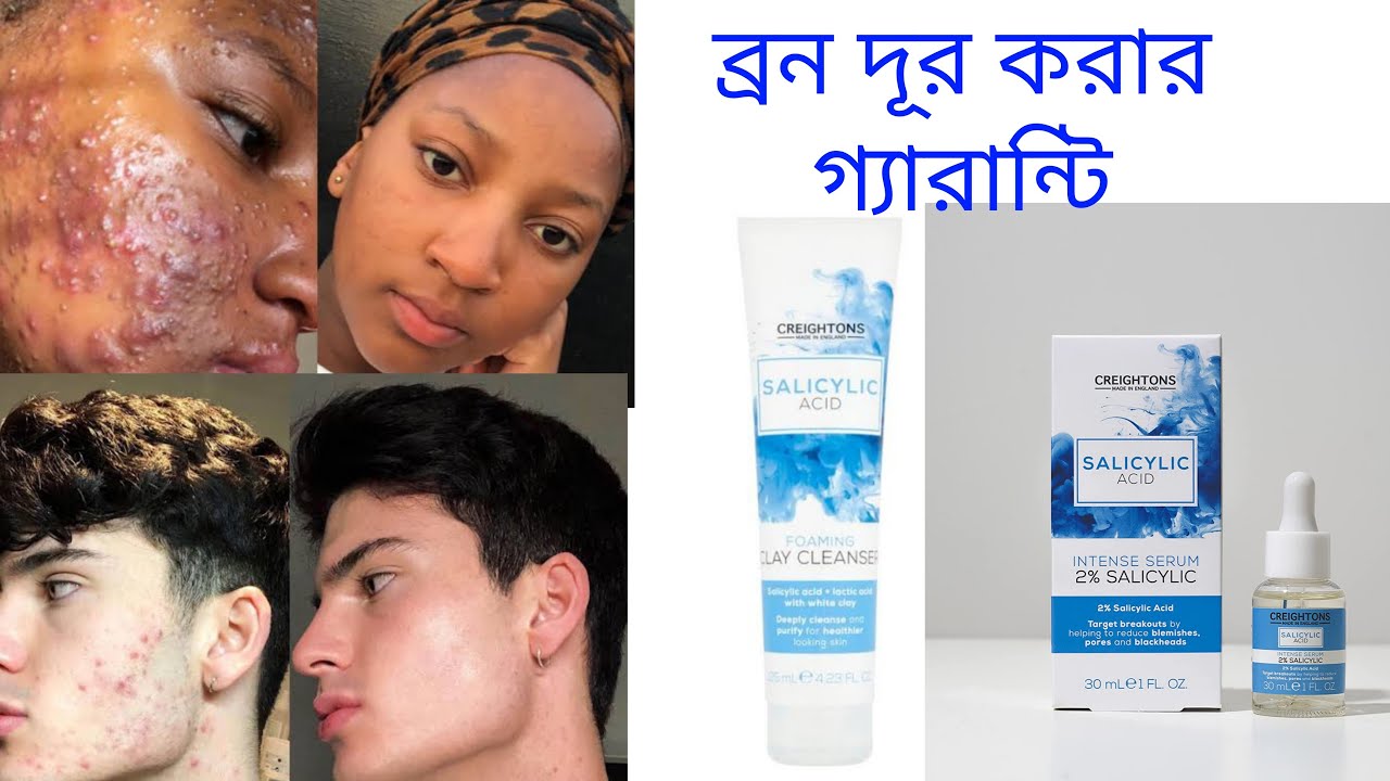 Creightons Salicylic Acid Intense Serum 2 Salicylic Bangla Review