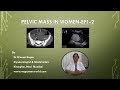 Pelvic Mass in Women ( Video series- Epi-2)