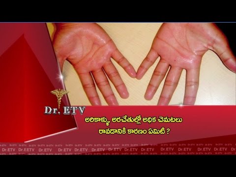 Dr.ETV - Reasons for sweating in palms and feet - 12th May 2016 - డాక్టర్ ఈటివీ