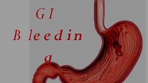 GI Bleed (Upper GIT Bleeding) Part 1