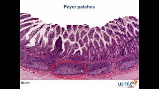 USMLE-Rx Express Video of the Week: Peyer Patches