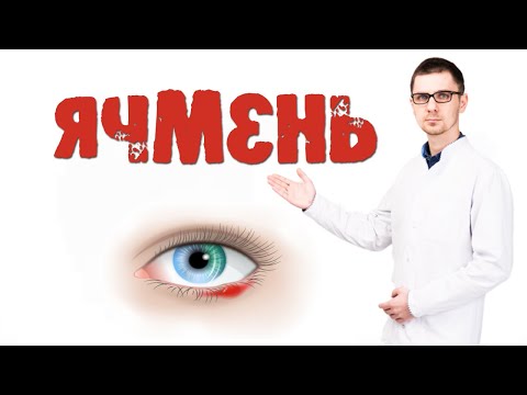 Ячмень на глазу причины и лечение