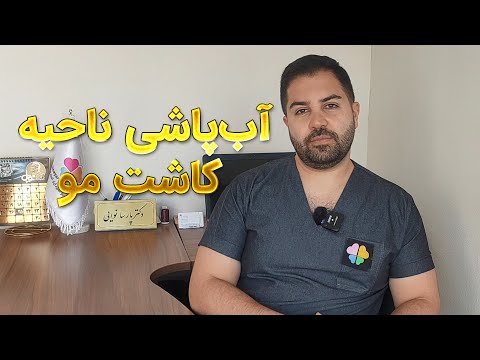 نحوه صحیح آب پاشی ناحیه کاشت مو