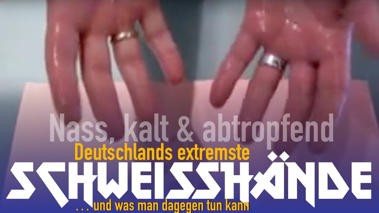 Schweisshande Handschweiss Verschwitzte Hande Schwitzen Com Ratgeber Schwitzen Korpergeruch