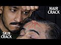 Unlimited Hair Cracking &amp; Crunchy Neck Cracking | Head Massage ASMR | Chest Massage &amp; Spine Cracking