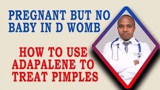 BLIGHTED OVUM; WHAT TO DO WHEN U GET PREGNANT WITH NO BABY IN D WOMB, how to use Adapalen on pimples
