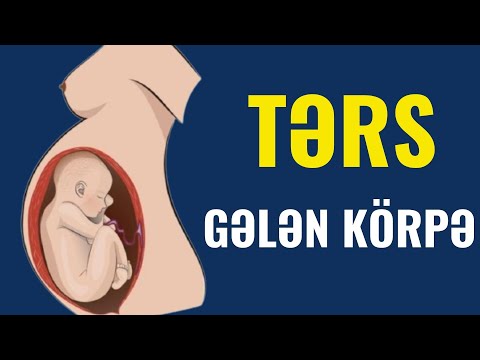 Video: Menstruasiyanın gəlişini necə gecikdirmək olar və bu mümkündürmü?