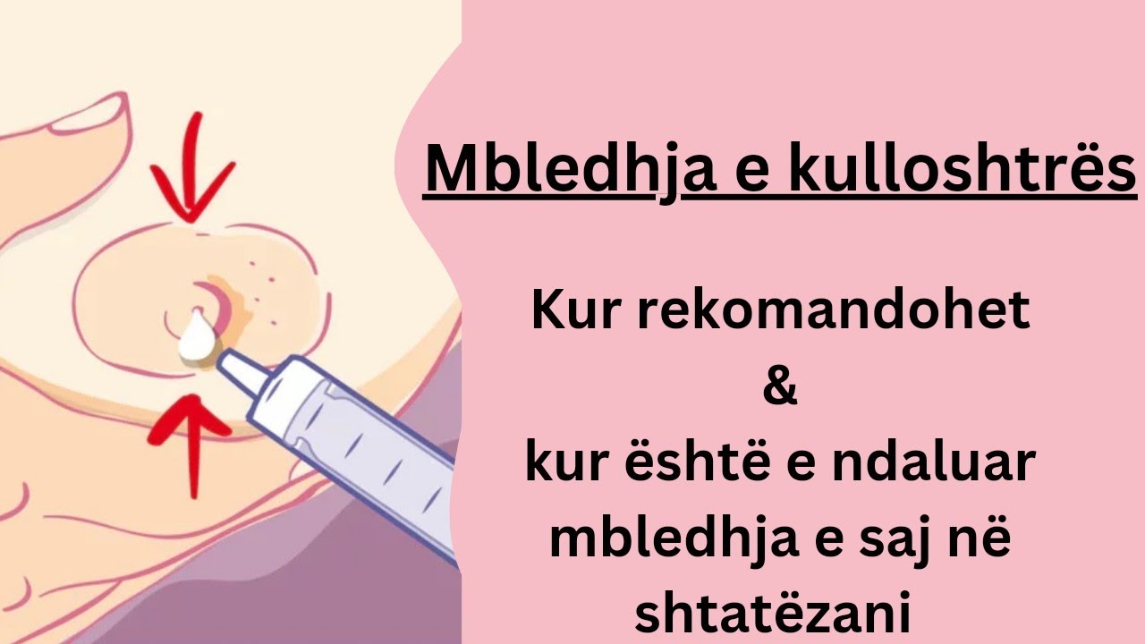 Mbledhja e kulloshtrës në shtatëzani❗Kur rekomandohet dhe kur është e ndaluar mbledhja e saj❓