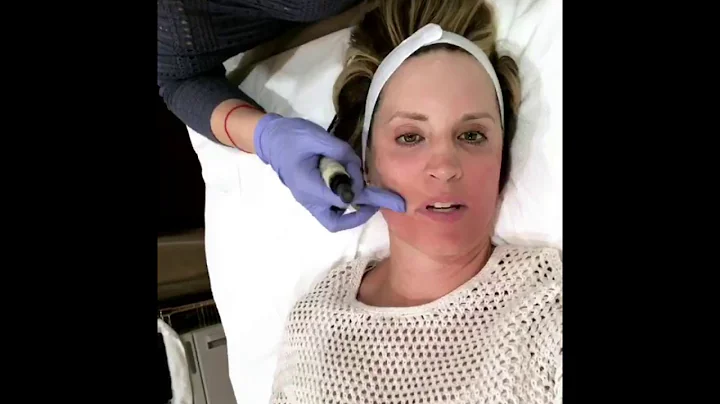 Vampire Facial with Kathryn Russo
