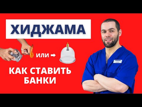 Курс Хиджама Обучение 12. Как Ставить Банки Для Хиджамы