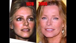 Cheryl Ladd Plastic Surgery