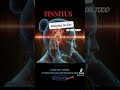 Tinnitus