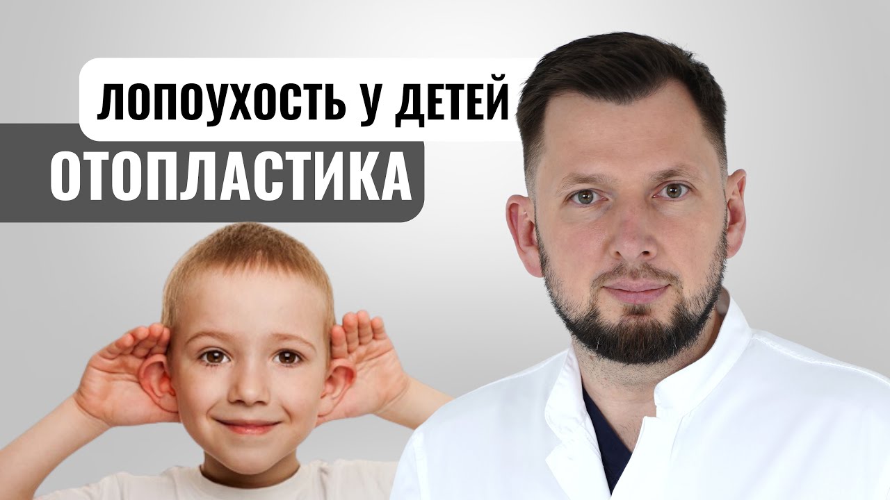 Лопоухость у детей