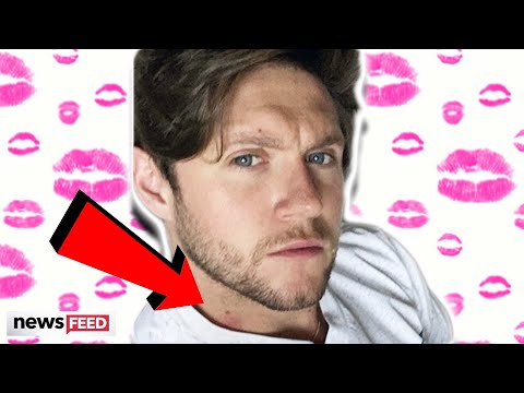 Niall Horan Spotted With A HICKEY In New Photo?!?