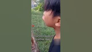 detik detik bocil di sengat tawon