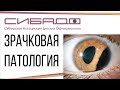 Зрачковая патология - взгляд нейроофтальмолога