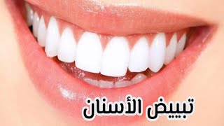 تبييض الأسنان من أول استعمال إزالة الإصفرار والجير تصبح لامعة كاللؤلؤ