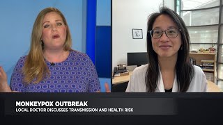 Local doctor discusses Monkeypox outbreak