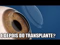 Como é VIVER com CERATOCONE depois de um TRANSPLANTE de CÓRNEA