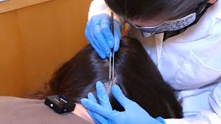 ASMR School Nurse LICE Check on 2 Students but 1 INFESTED | Removal with Tweezers (Real Person)