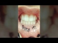 Tatuajes en la boca