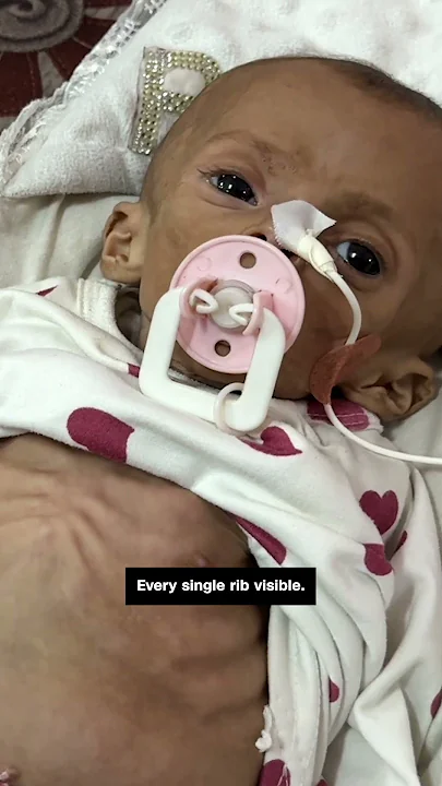 Surgeon shows humanitarian crisis in Gaza’s hospitals
